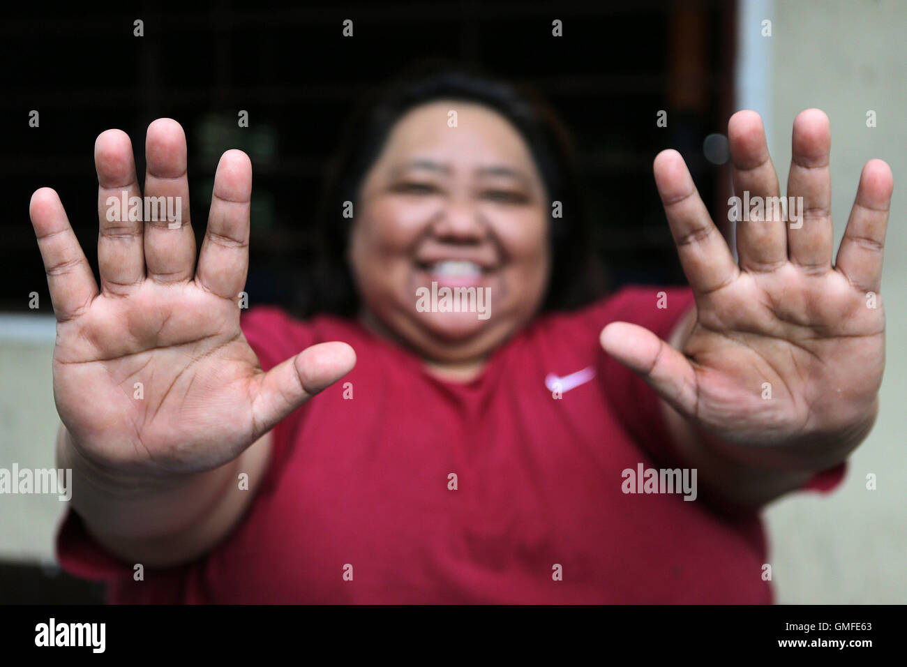 Quezon City, Philippines. 27th Aug, 2016. Philippine powerlifter Adeline Dumapong-Ancheta shows her hands before a training session in preparation for the Rio Paralympic Games in Quezon City, the Philippines, Aug. 27, 2016. Adeline Dumapong-Ancheta, a polio victim since she was three years old, has won many medals in powerlifting events in various international competitions and is qualified to compete in the Rio Paralympic Games in September. © Rouelle Umali/Xinhua/Alamy Live News Stock Photo