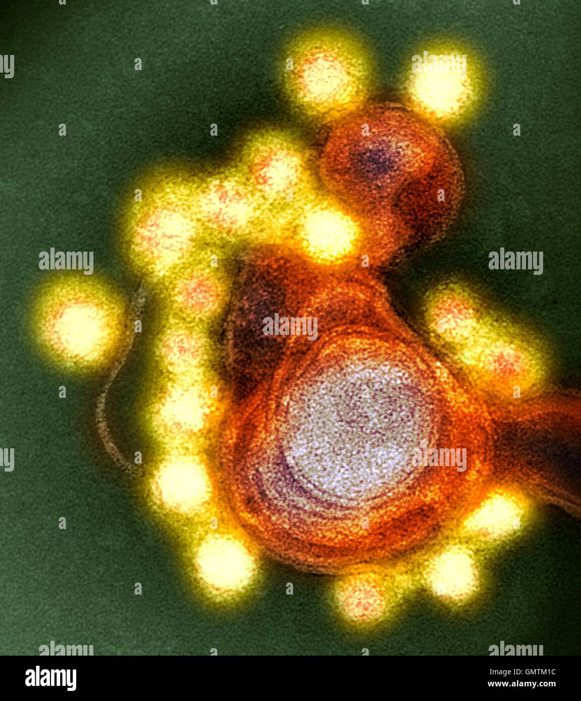 Zika virus particles. Coloured transmission electron micrograph (TEM) of negative-stained Fortaleza-strain Zika virus particles (yellow) isolated from a microcephaly case in Brazil. Zika is an RNA (ribonucleic acid) virus from the Flaviviridae family. It Stock Photo