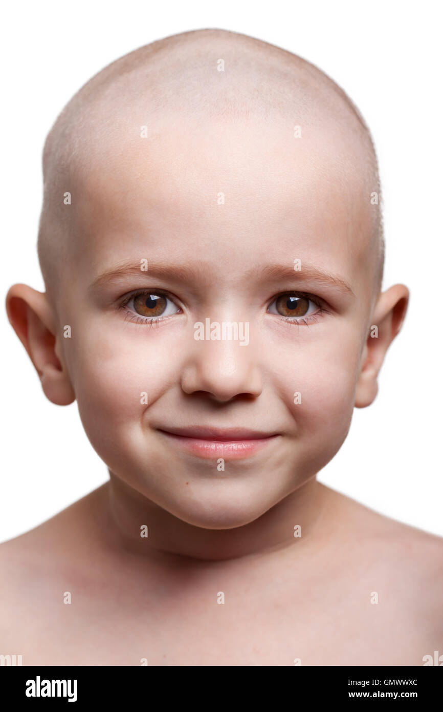 Bald - лысый. стрижка налысо ребенка. стрижка мальчика налысо. лысые маленькие дети. лысый малыш.