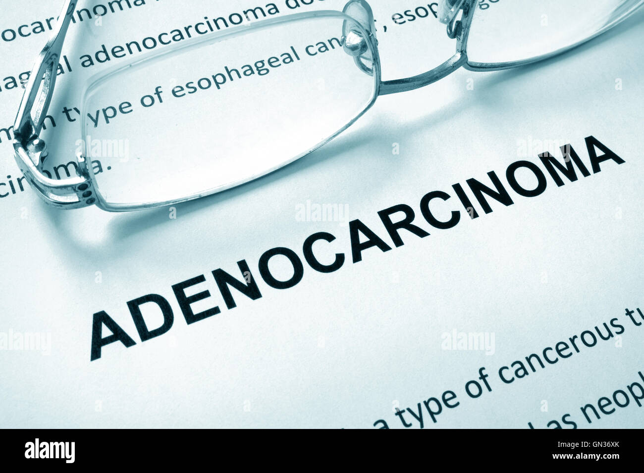 Paper with word adenocarcinoma and glasses. Medical concept. Stock Photo