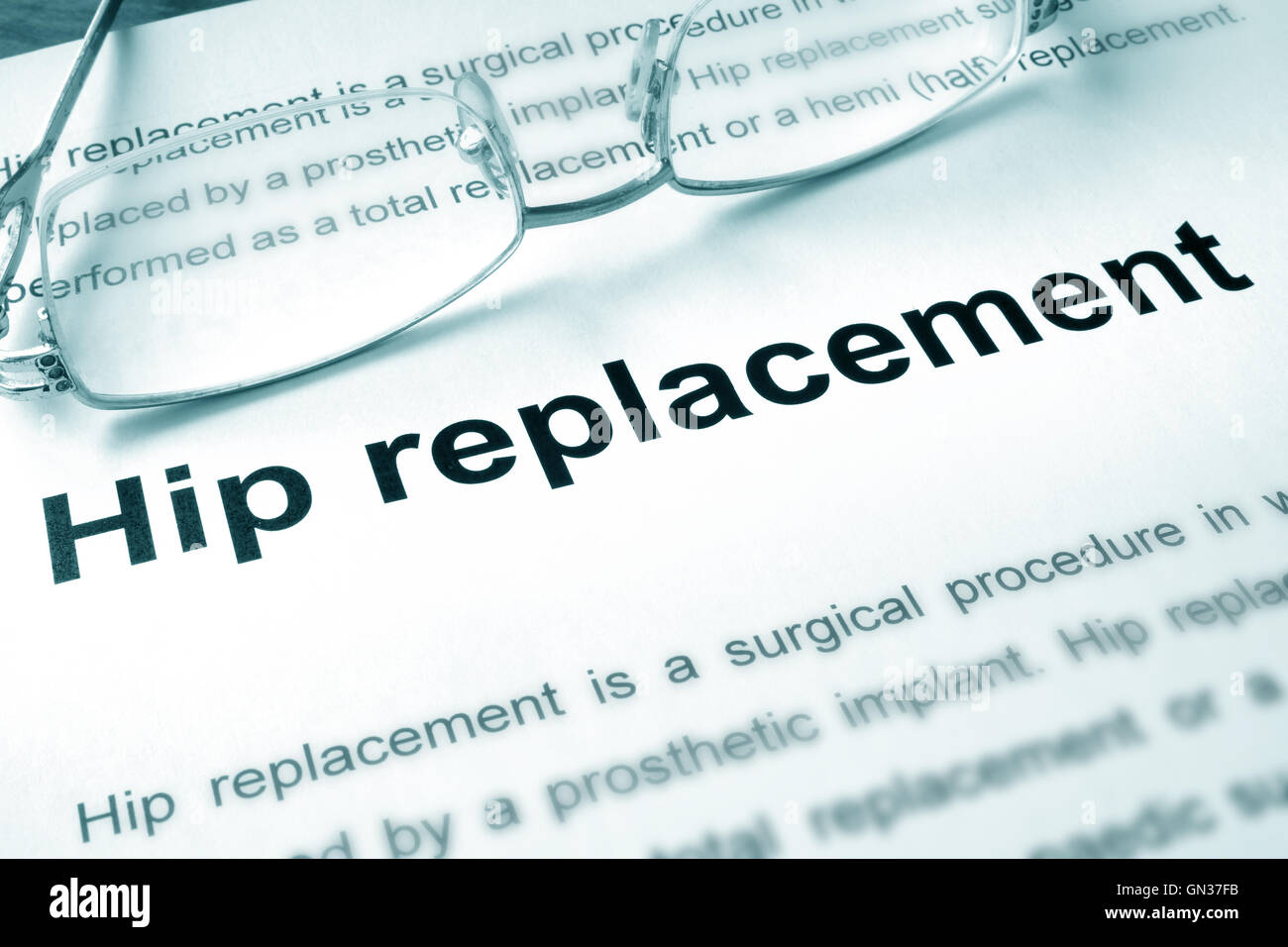 Hip replacement written on a page. Medical concept Stock Photo Alamy