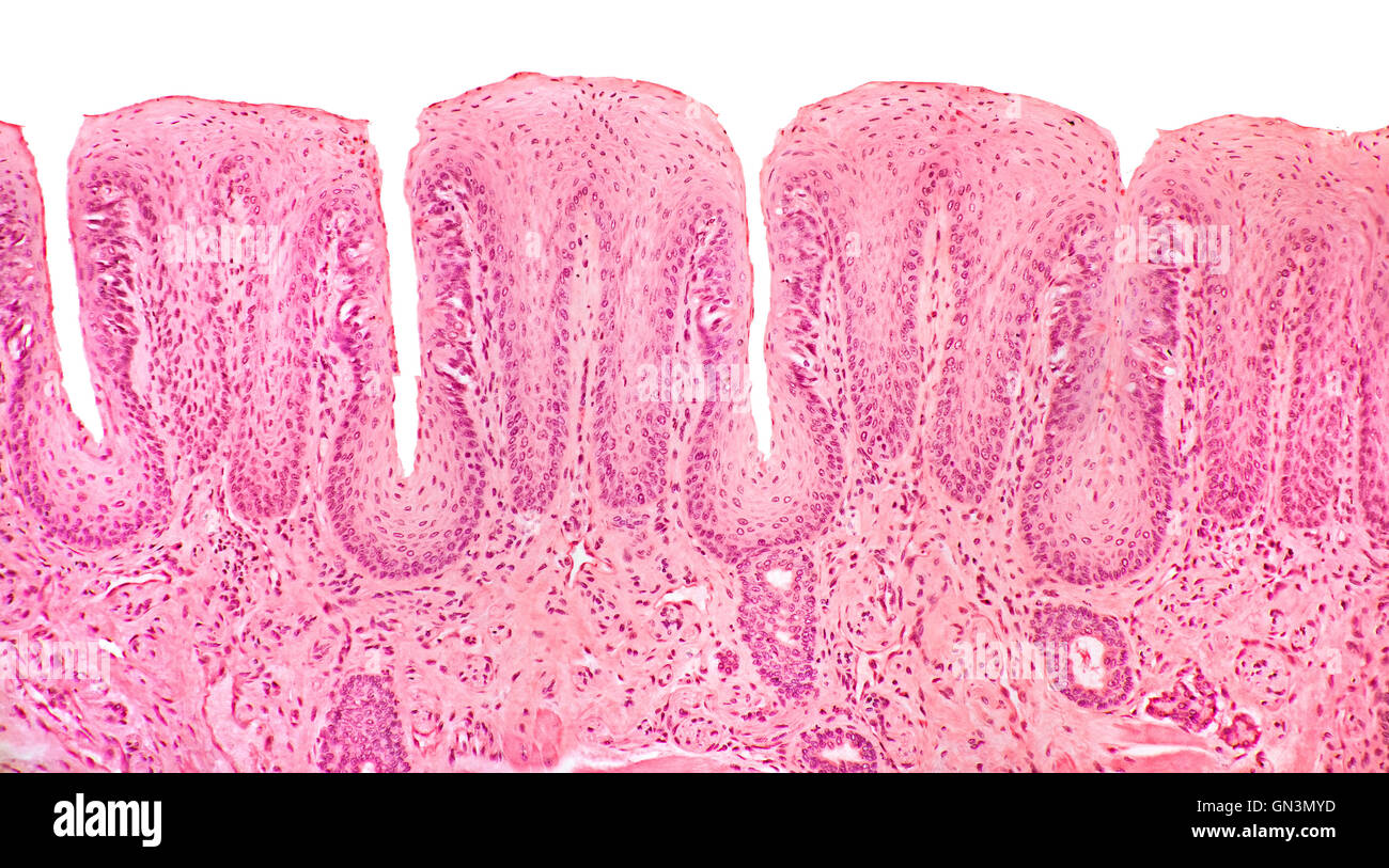 Human tongue TS brightfield photomicrograph showing papillae Stock Photo
