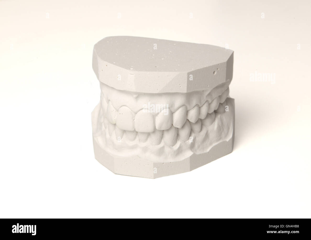 Plaster cast of set of teeth Stock Photo Alamy