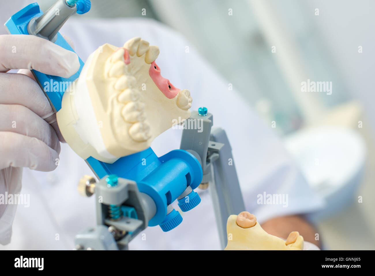 Dental mould hires stock photography and images Alamy