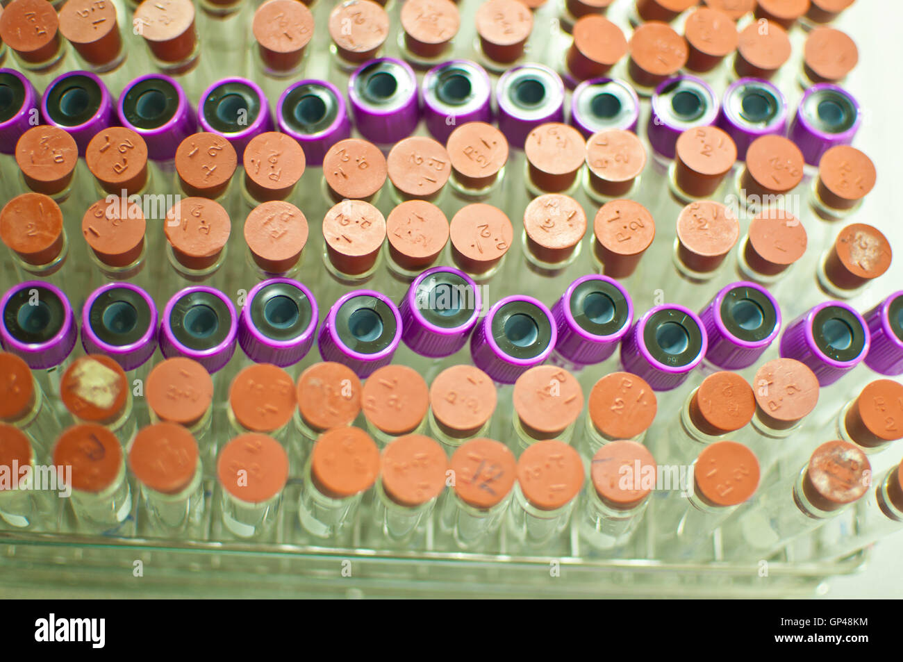 many test tubes for blood test Stock Photo Alamy