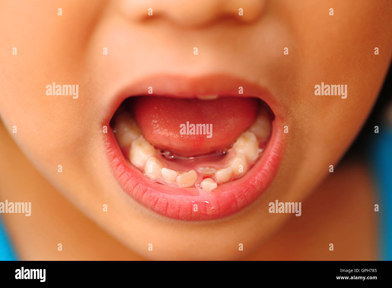 Child loose tooth Stock Photo Alamy
