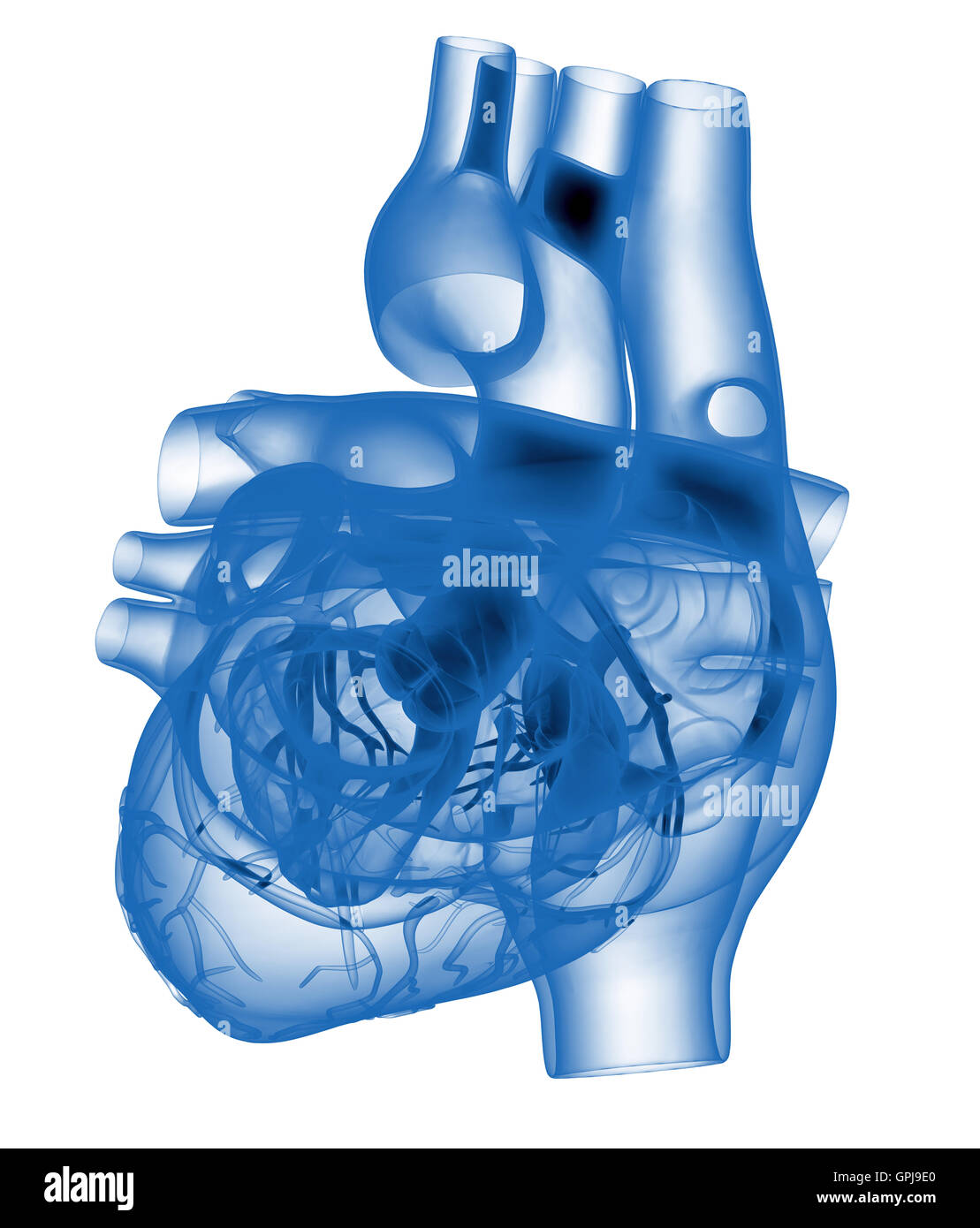 Human Heart X Ray High Resolution Stock Photography and Images Alamy