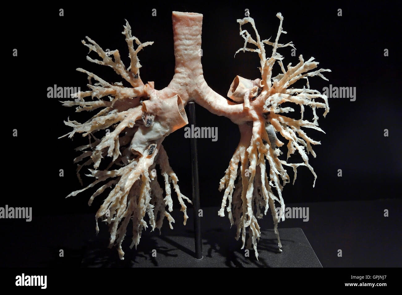 Real Human Body Lungs