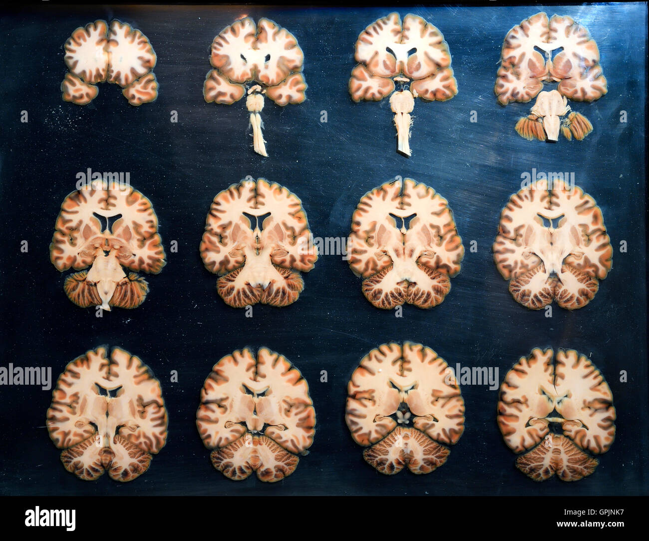 Plastinate, cross sections through human brain, Body Worlds, Menschen Museum, Berlin, Germany Stock Photo