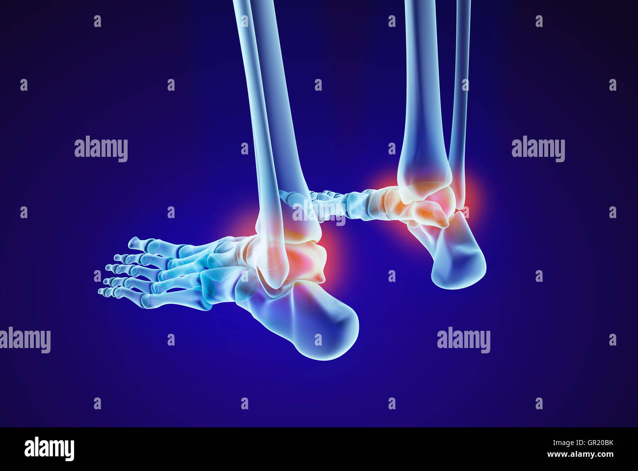 Skeletal foot injuryd talus bone. Xray view. Medically accurate 3D