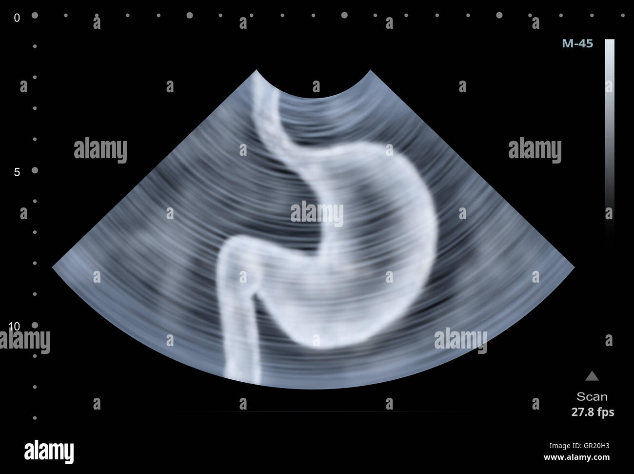 Ultrasound scan of human Stomach. Illustration Stock Photo