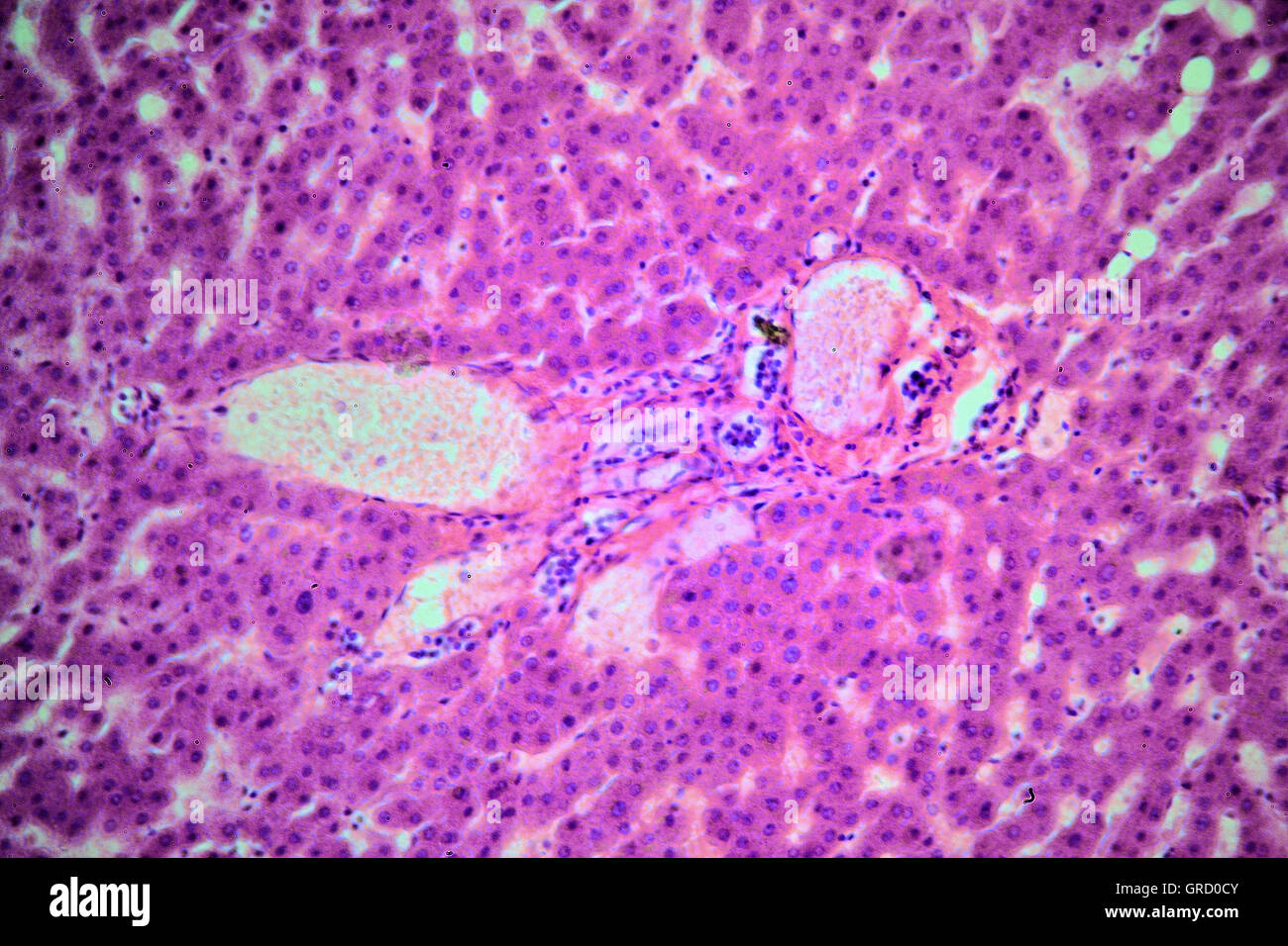 Liver Cells Microscope High Resolution Stock Photography And Images Alamy