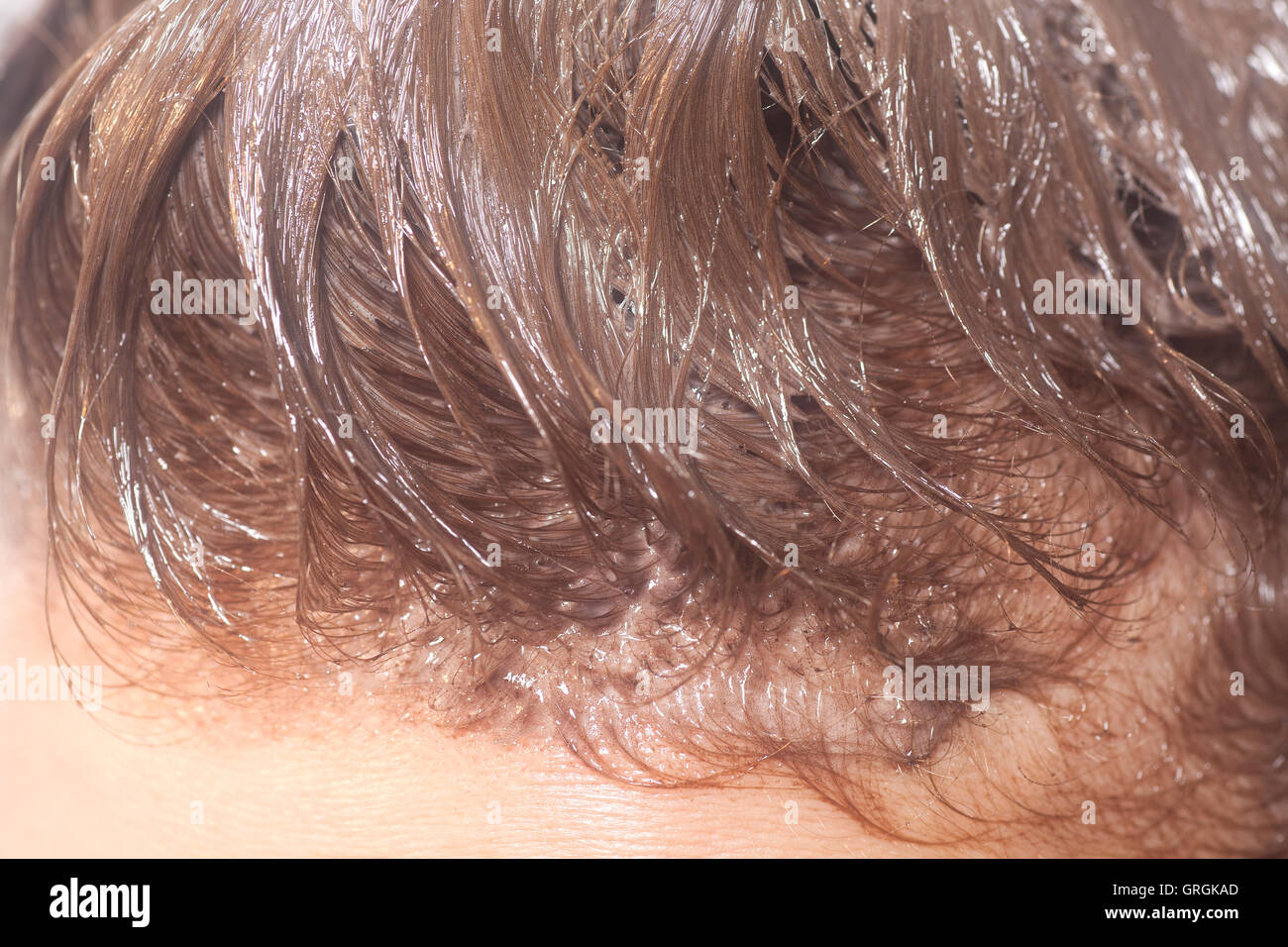 Hair colouring in process hi-res stock photography and images - Alamy