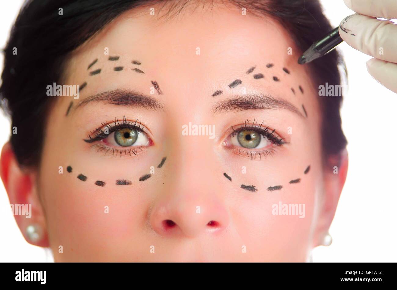 Closeup headshot caucasian woman with dotted lines drawn around eyes looking into camera, preparing cosmetic surgery Stock Photo