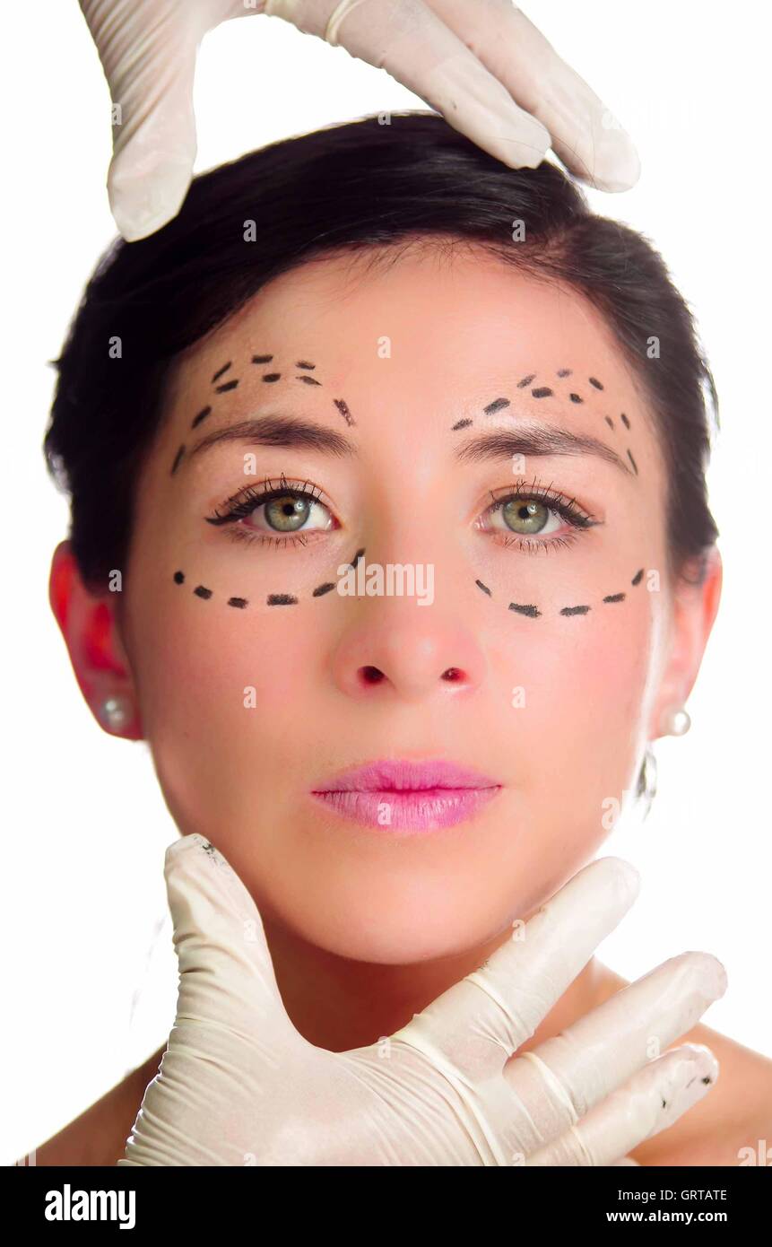 Headshot caucasian woman with dotted lines drawn around eyes looking into camera, doctors hands holding her head, preparing cosmetic surgery Stock Photo