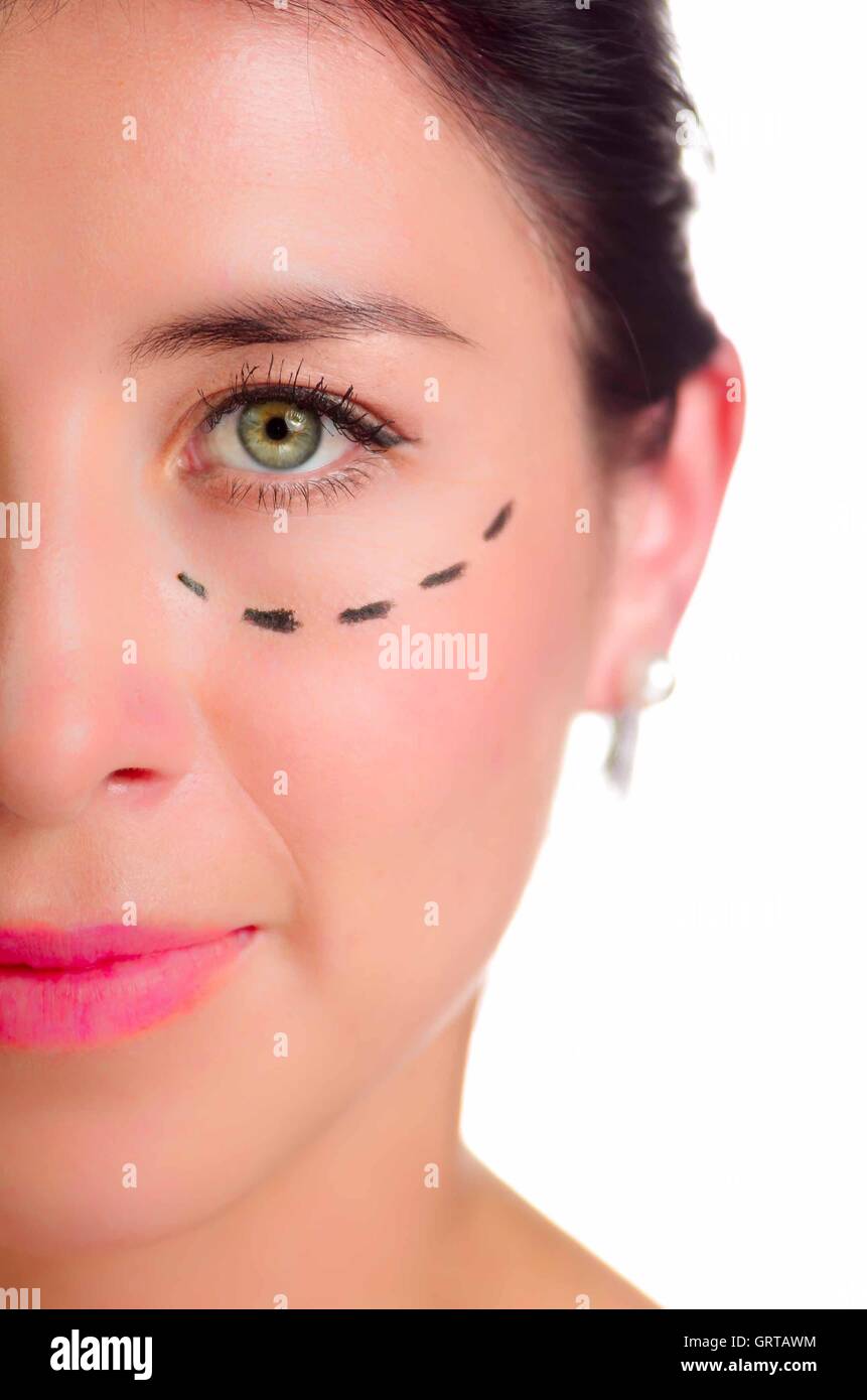 Closeup half of face caucasian woman with dotted lines drawn around left eye, preparing cosmetic surgery Stock Photo