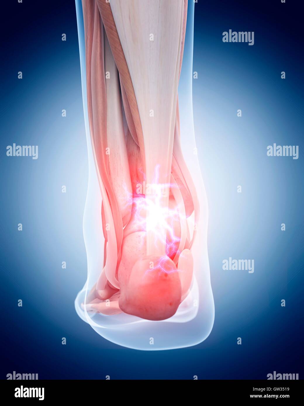 Human ankle pain, illustration Stock Photo - Alamy