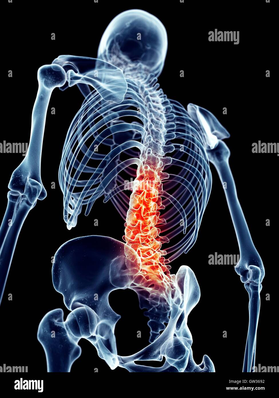 Human spine pain, illustration. Stock Photo