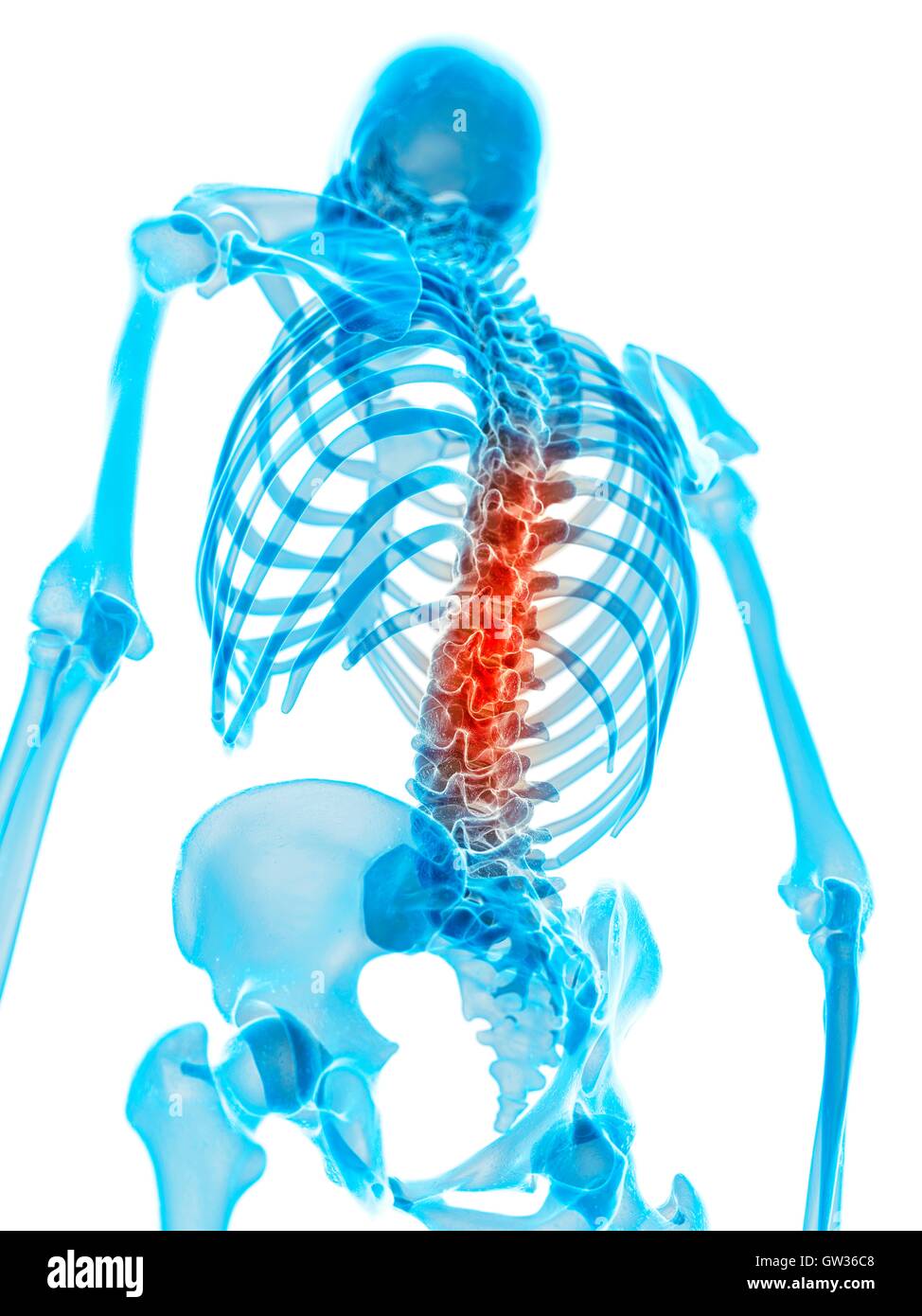 Human spine pain, illustration. Stock Photo