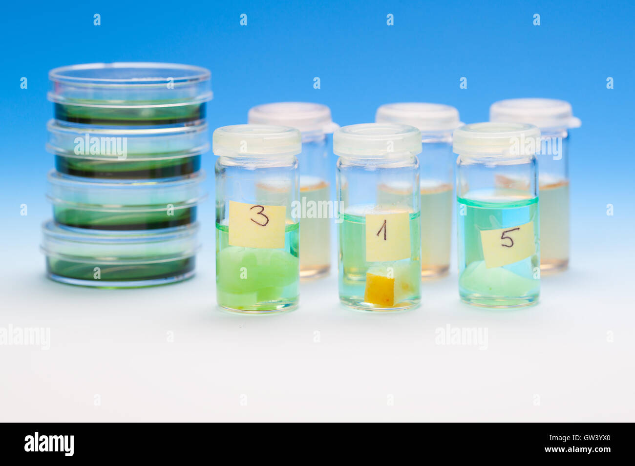 samples in plastic vials for microscopy and biopsy tissue. biolo Stock Photo