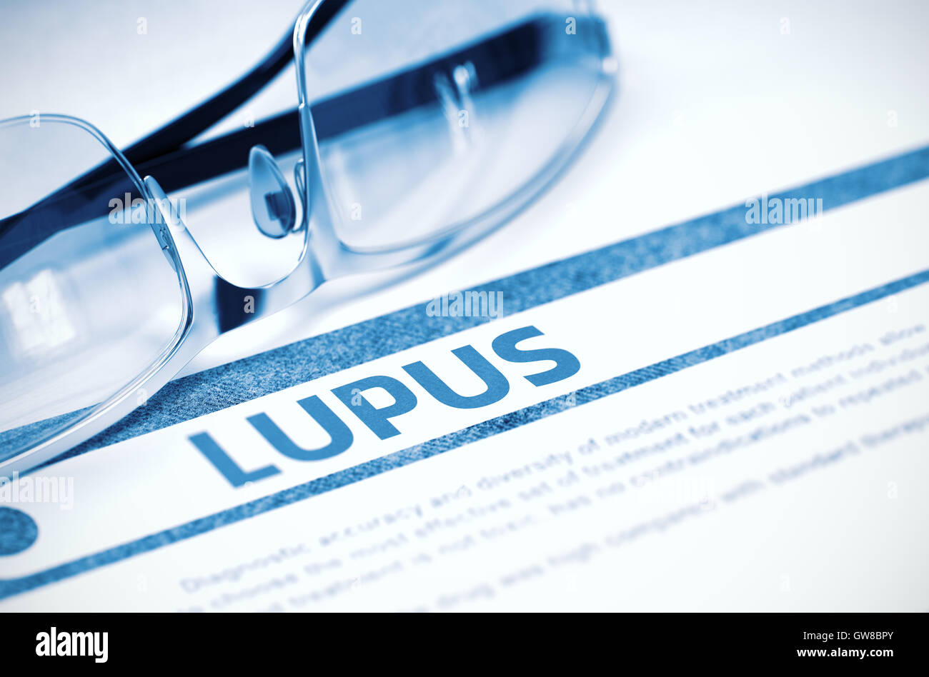 Lupus - Printed Diagnosis. Medical Concept. 3D Illustration. Stock Photo