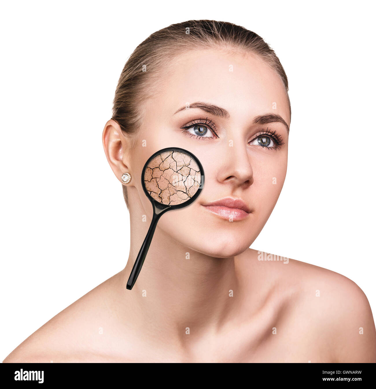 Face of young woman with dry skin Stock Photo - Alamy