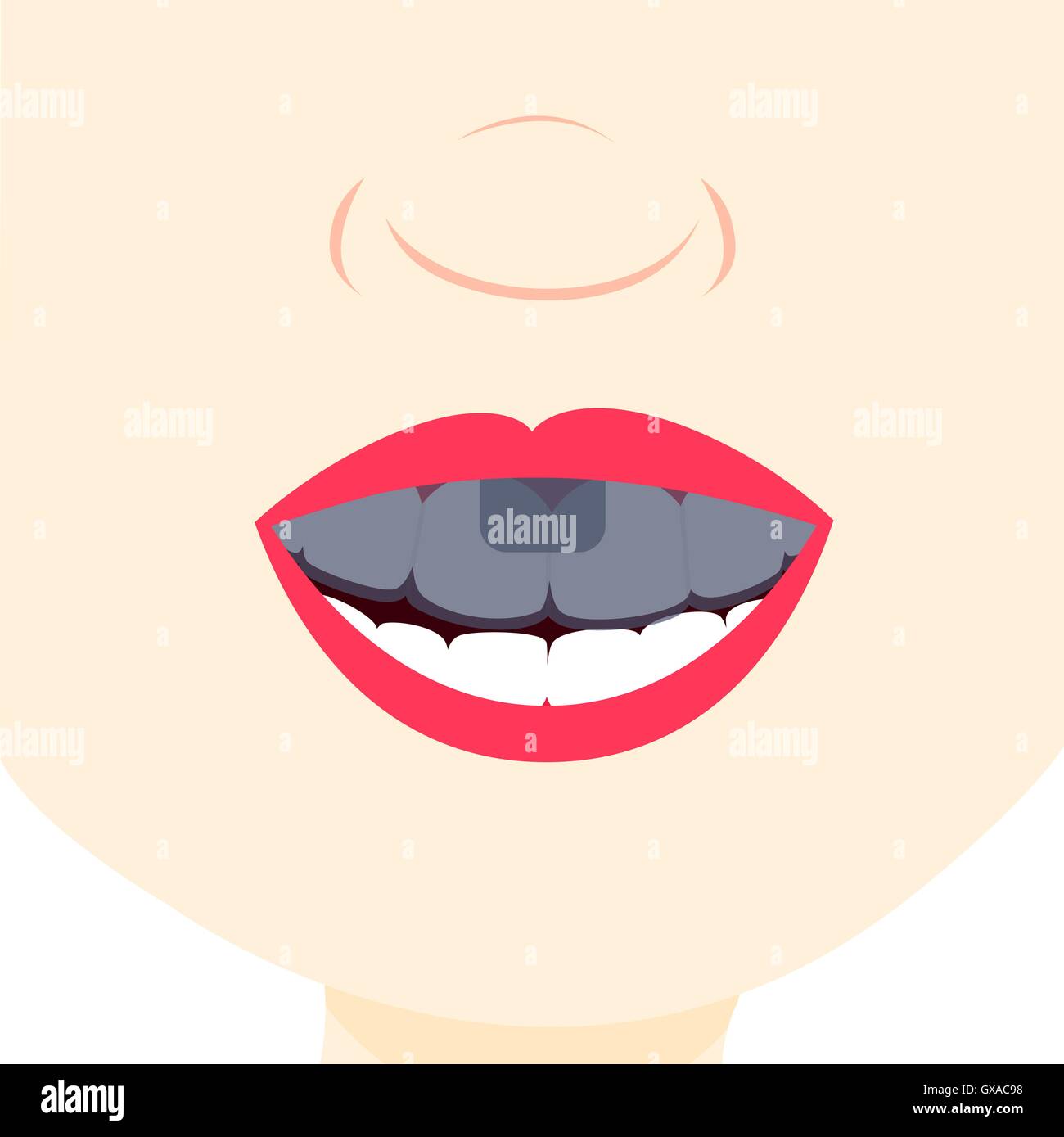 Smile and showing teeth with dental tray. Dental treatment.  Close up in the mouth. Stock Vector