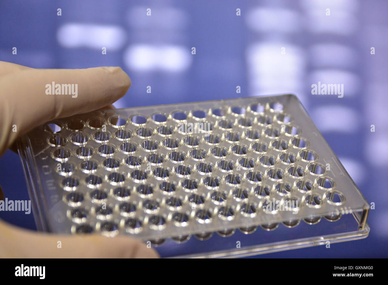 Image showcasing Tests in Medical Science Laboratory. DNA testing for the diagnosis of ...