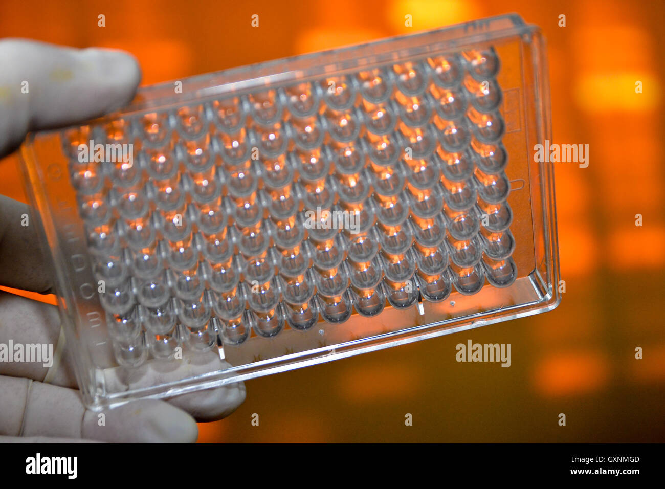 Tests in Medical Science Laboratory. DNA testing for the diagnosis of ... - Can Dna Tests Diagnose Disease