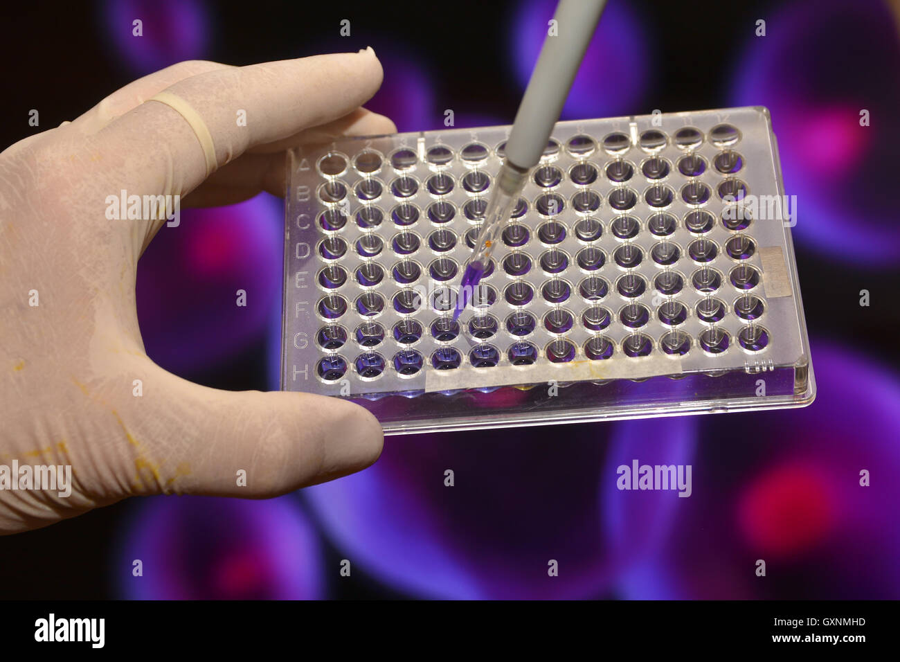 Tests in Medical Science Laboratory. DNA testing for the diagnosis of