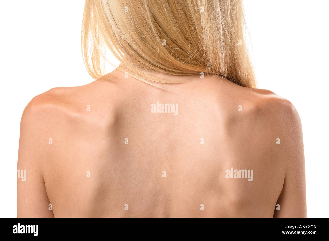 Rear view of the back of a thin woman showing the ribs and spine in a  concept of healthcare and eating disorder such as anorexia Stock Photo -  Alamy