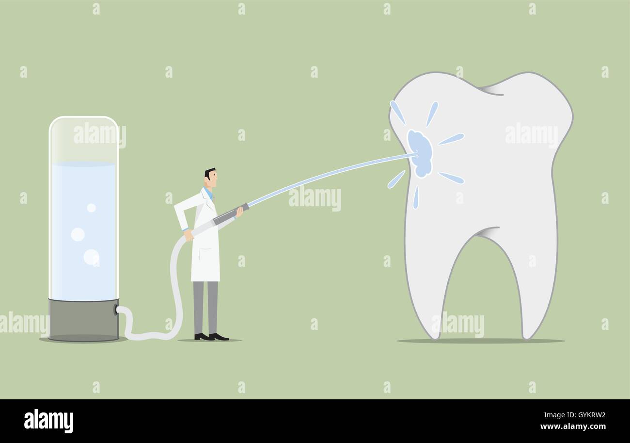 Dentist cleaning a big tooth Stock Vector Image & Art - Alamy
