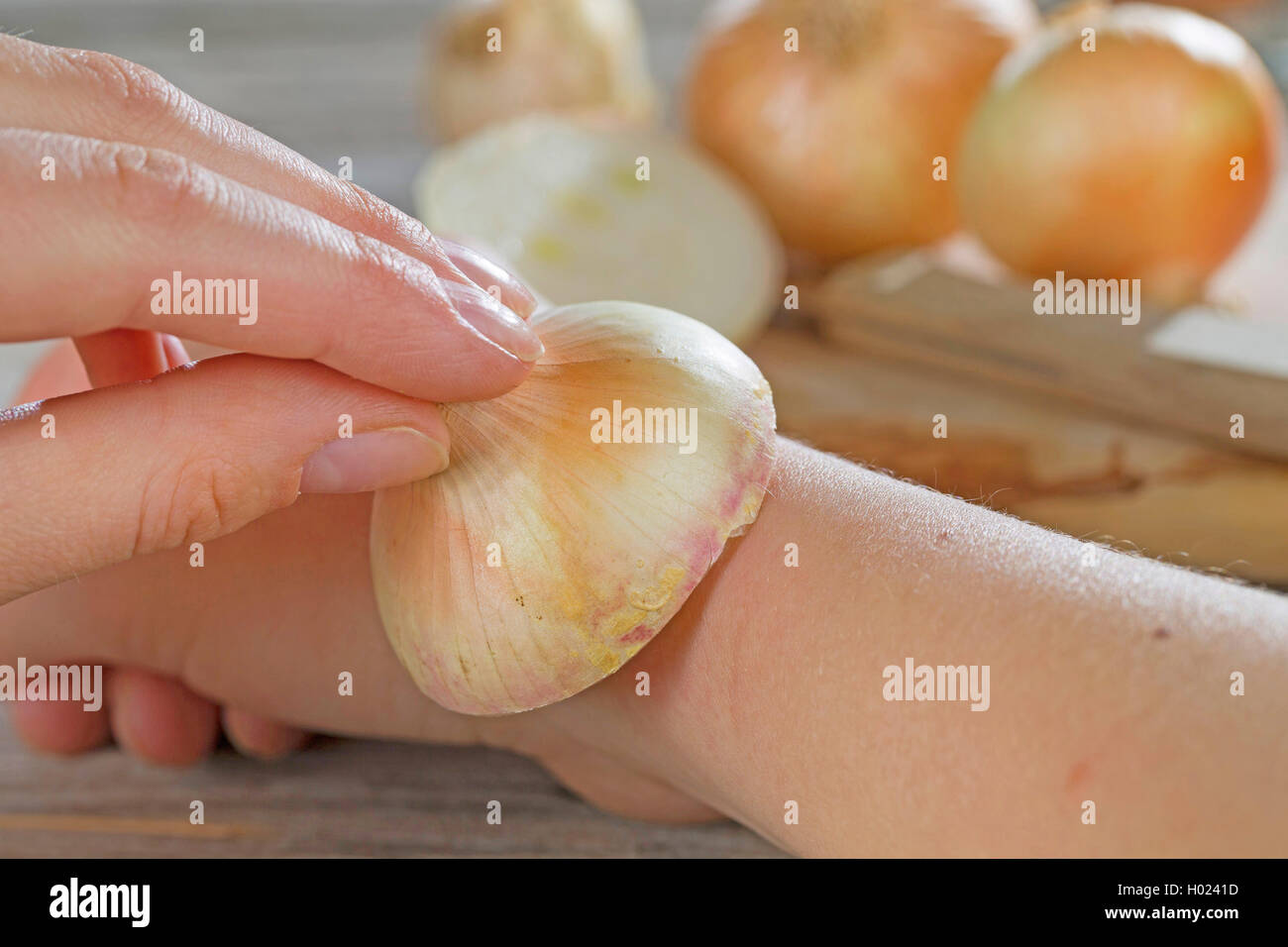 Garden onion, Bulb Onion, Common Onion (Allium cepa), using a onion against gnat bite, Germany Stock Photo