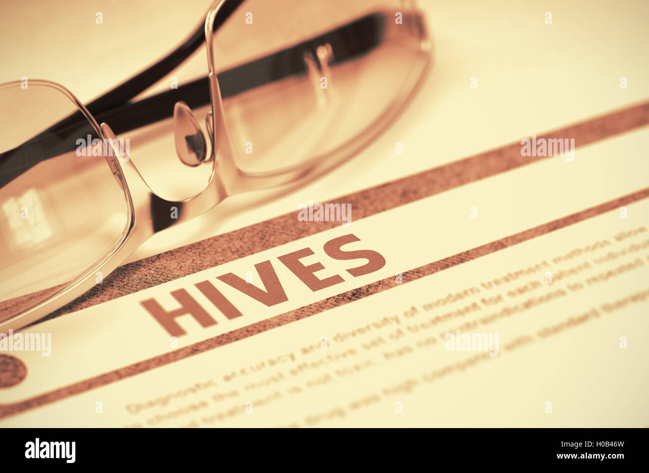 Hives. Medical Concept on Red Background. 3D Illustration. Stock Photo