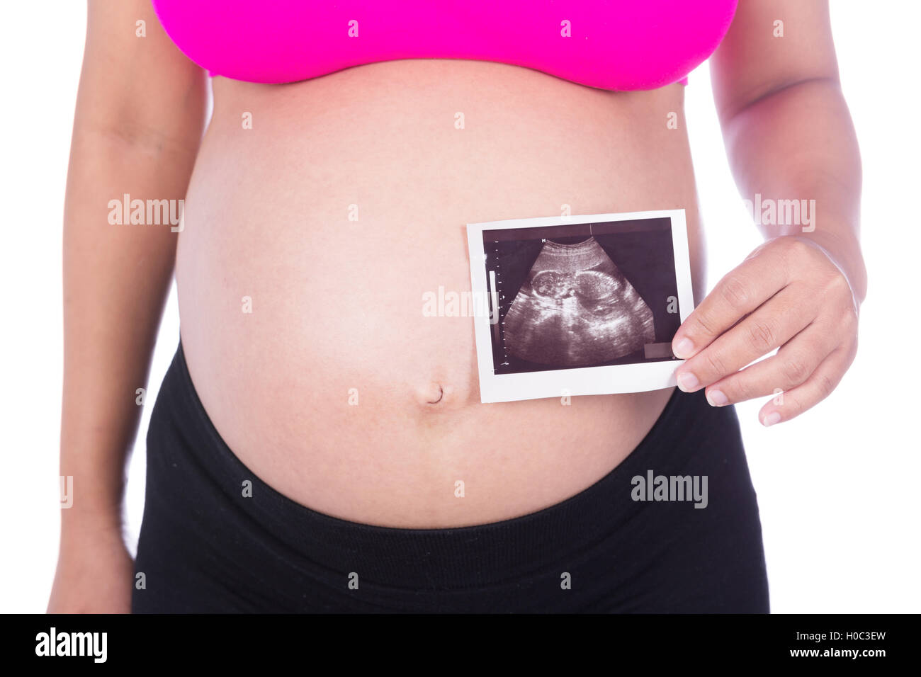 Pregnant woman hands holding ultrasound photo isolated on white background Stock Photo