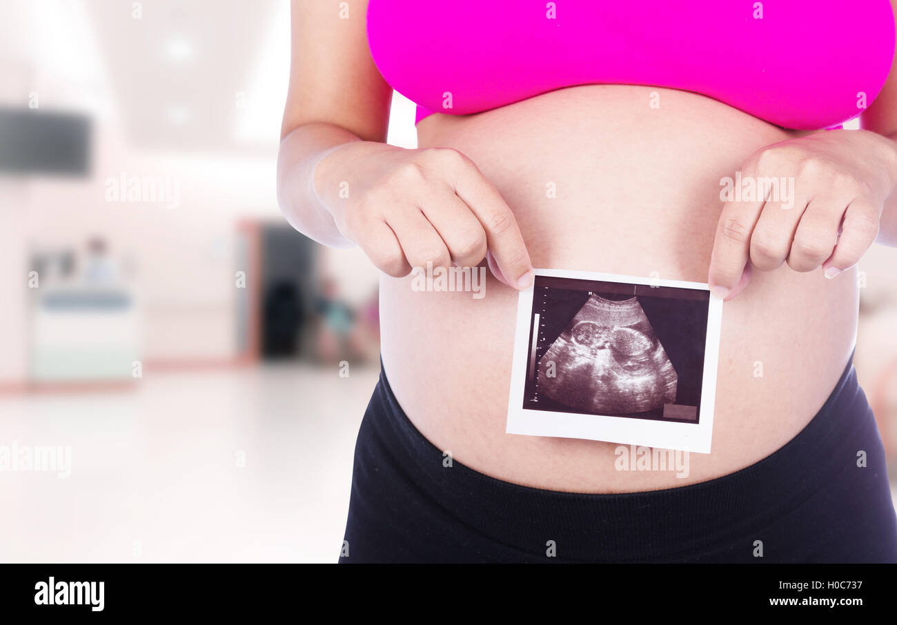 Pregnant woman hands holding ultrasound photo isolated in hospital background Stock Photo
