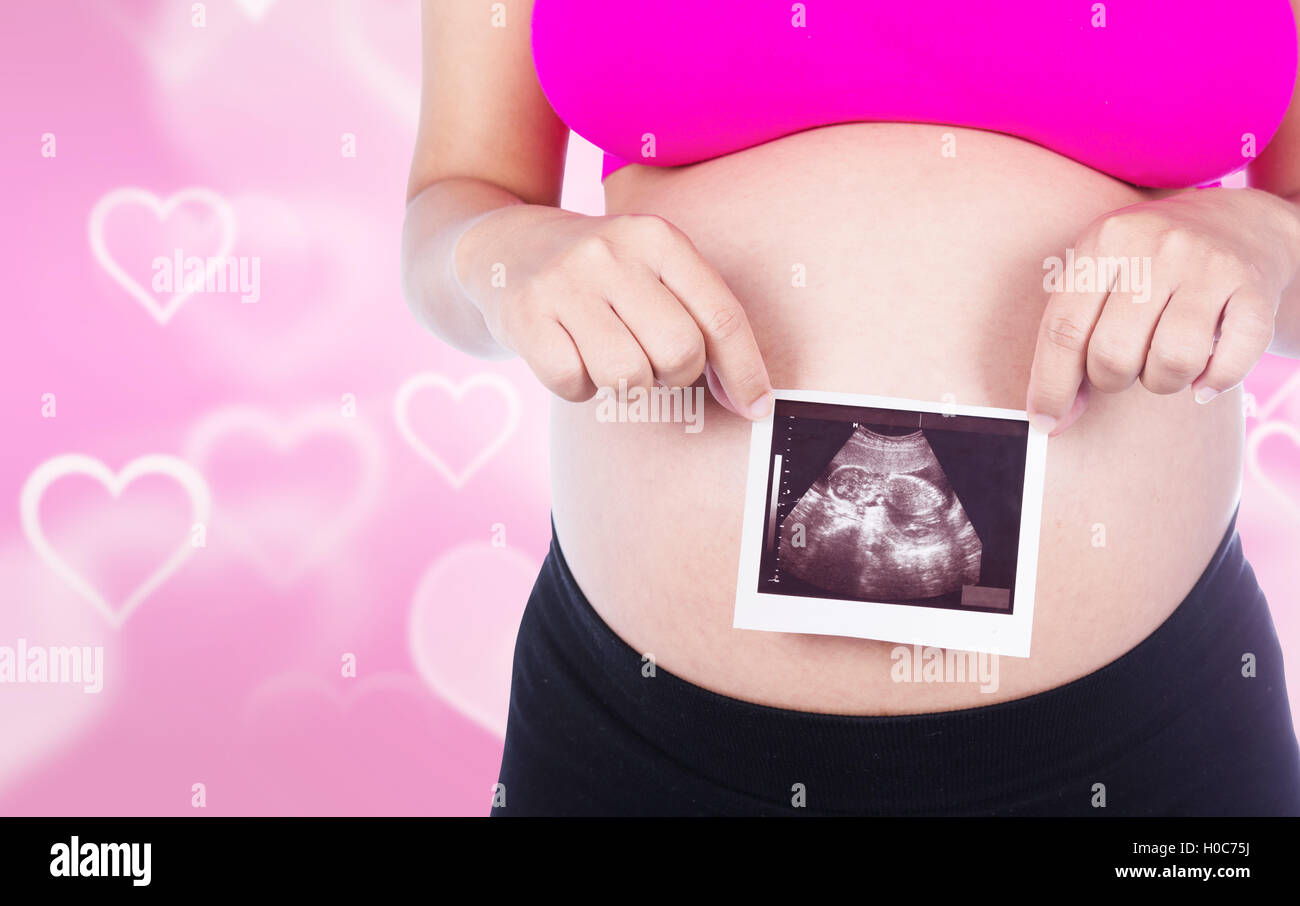 Pregnant woman hands holding ultrasound photo isolated on heart backrground Stock Photo