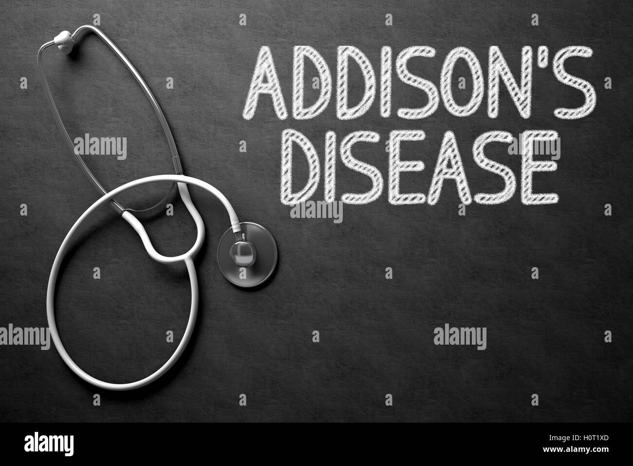 Addisons Disease on Chalkboard. 3D Illustration. Stock Photo