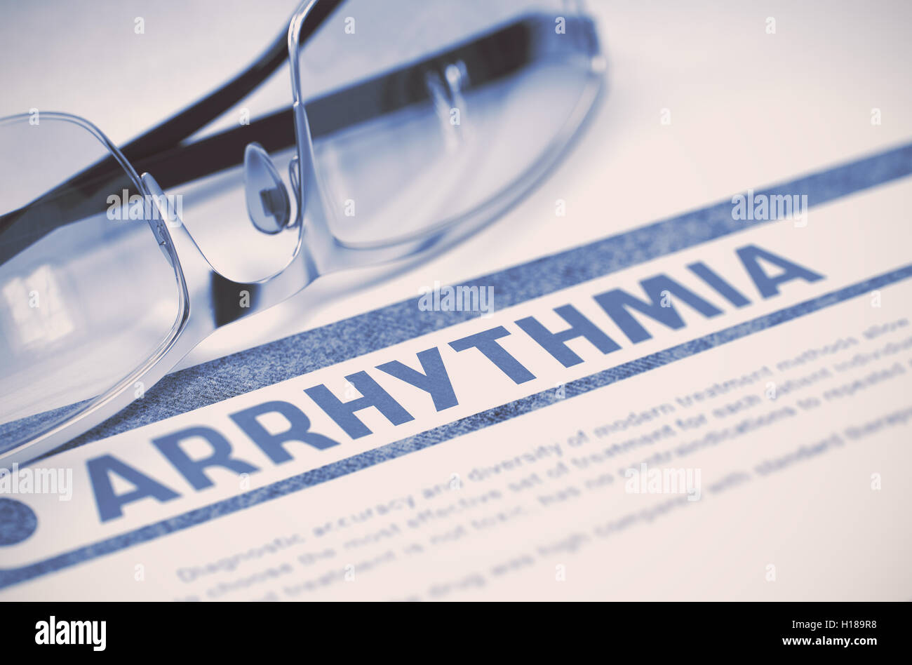 Arrhythmia. Medicine. 3D Illustration. Stock Photo
