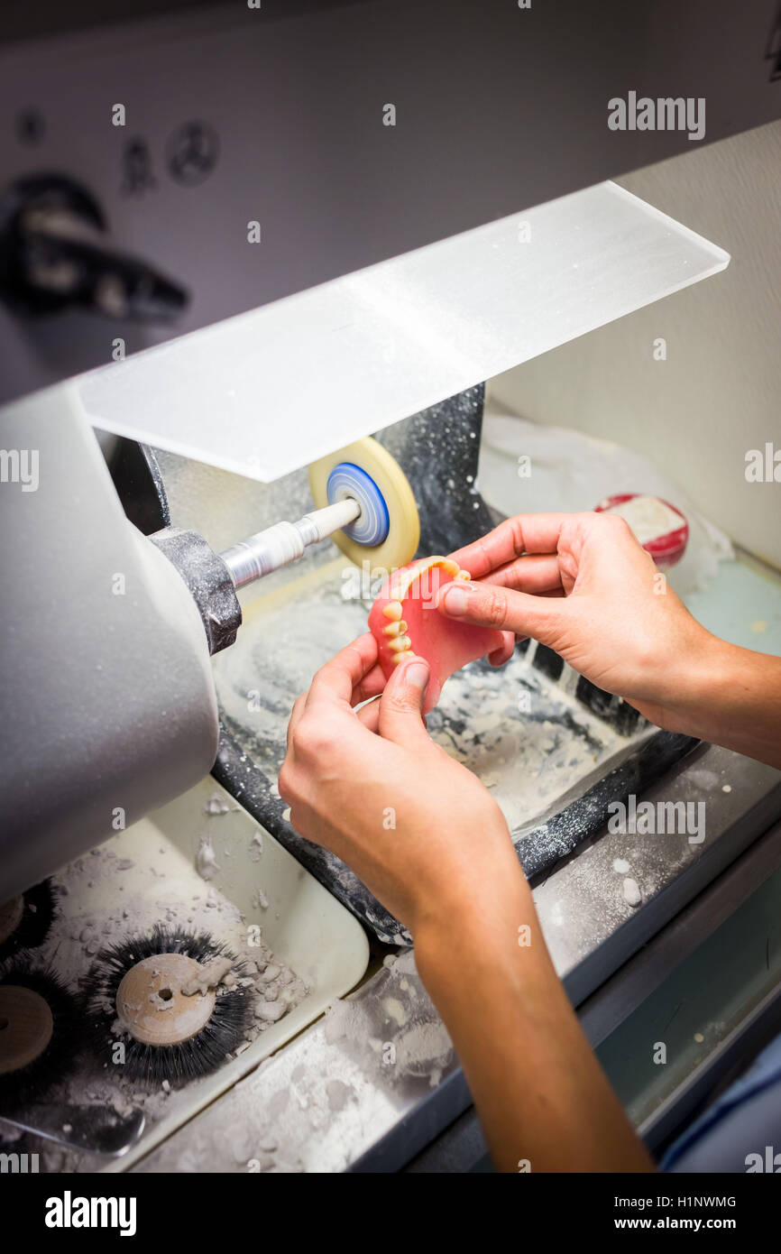 Fabrication of complete dentures. Stock Photo