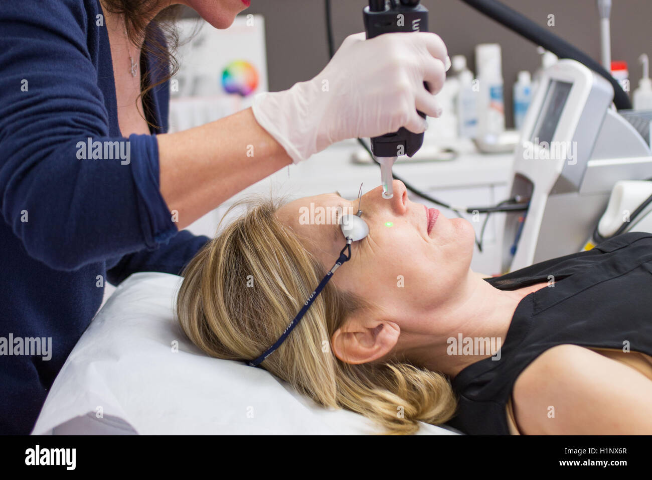 Vascular laser used in treatment of rosacea and varicosity Stock Photo