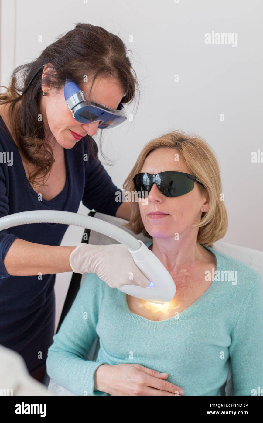Fractionated laser CO2. Here, treatment of wrinkles of the neckline. Stock Photo