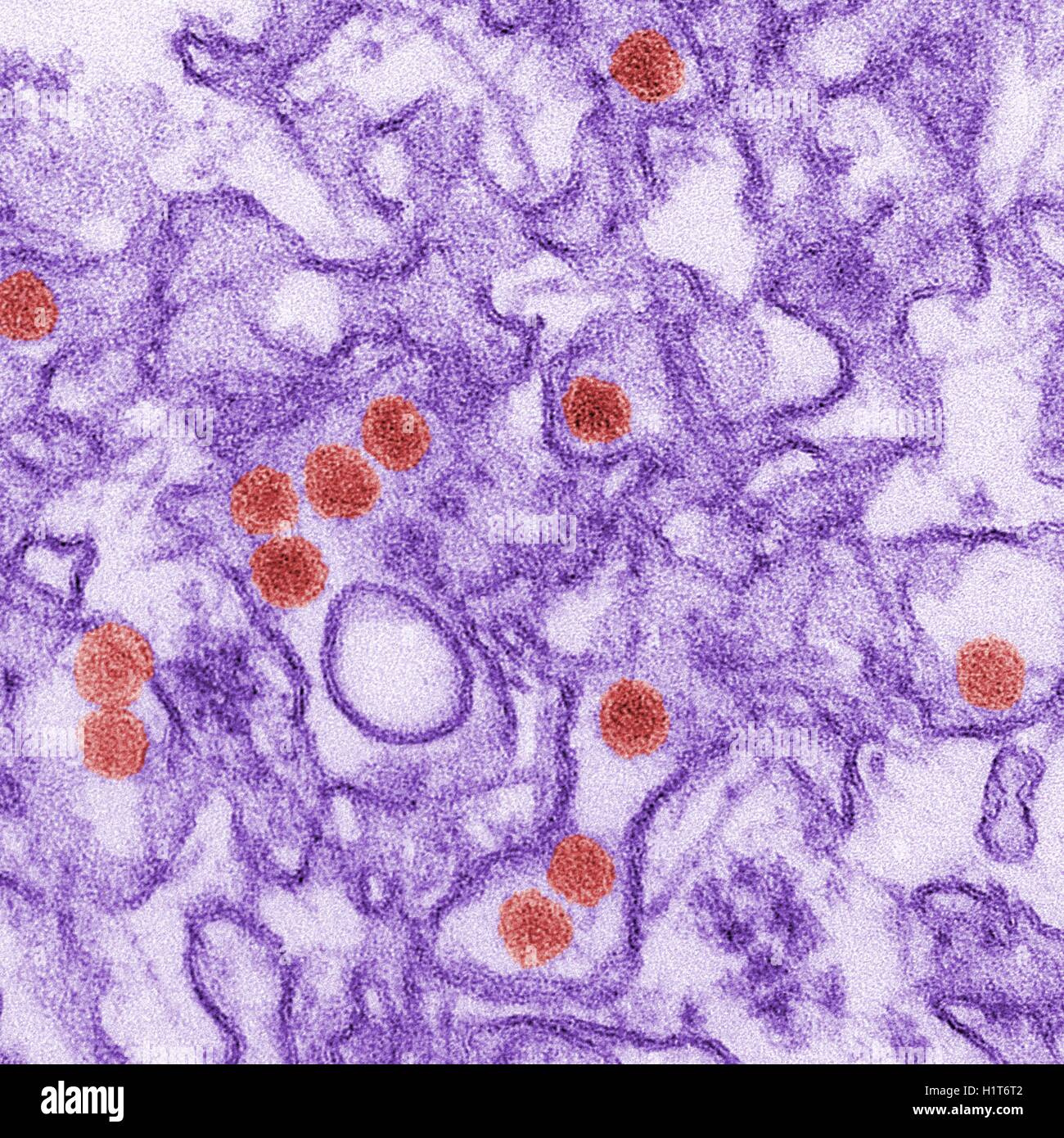 Zika virus. Coloured transmission electron micrograph (TEM). Stock Photo