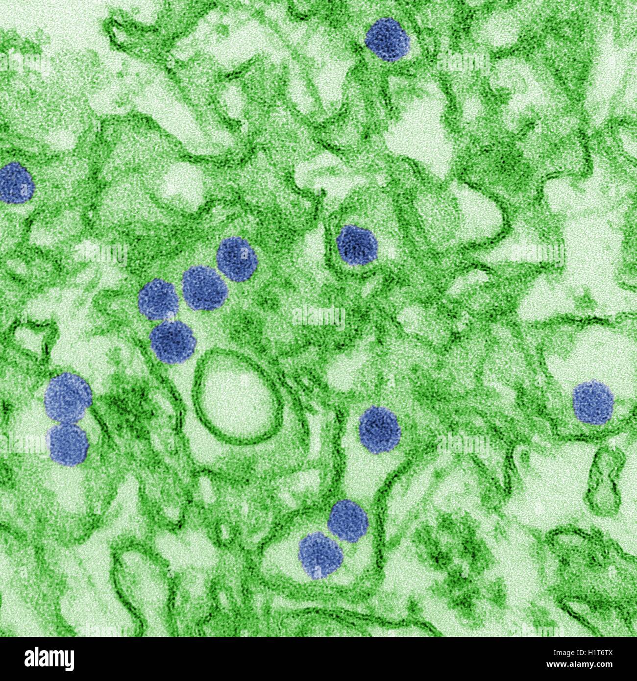 Zika virus. Coloured transmission electron micrograph (TEM). Stock Photo
