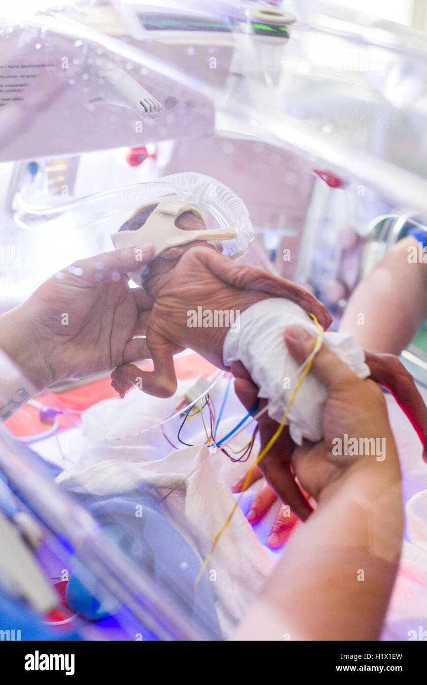 Premature newborn baby placed under respiratory assistance. Stock Photo