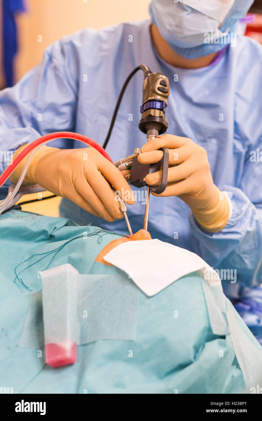 Sinus surgery. Surgeons performing functional endoscopic sinus surgery. Stock Photo