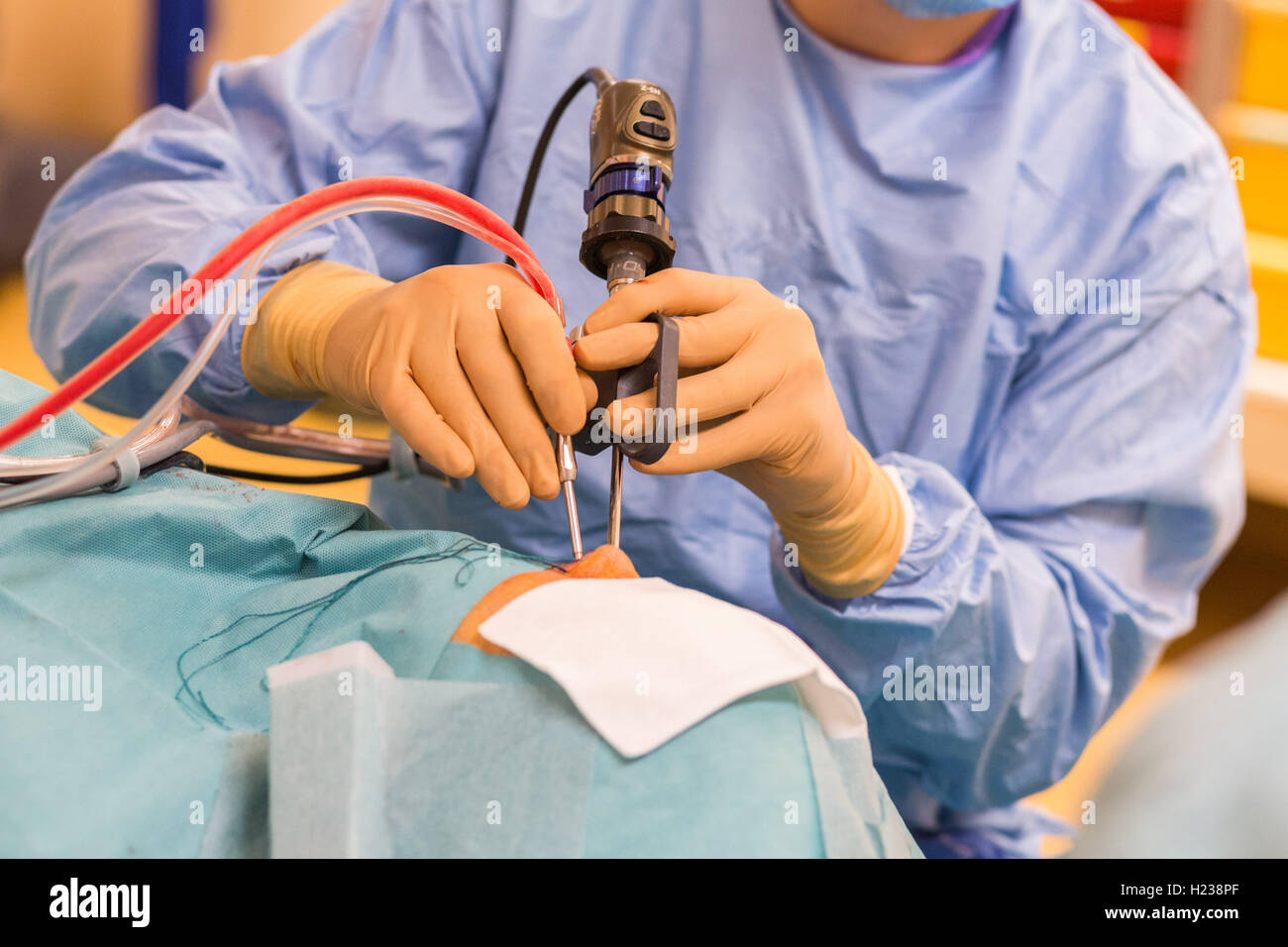 Sinus surgery. Surgeons performing functional endoscopic sinus surgery