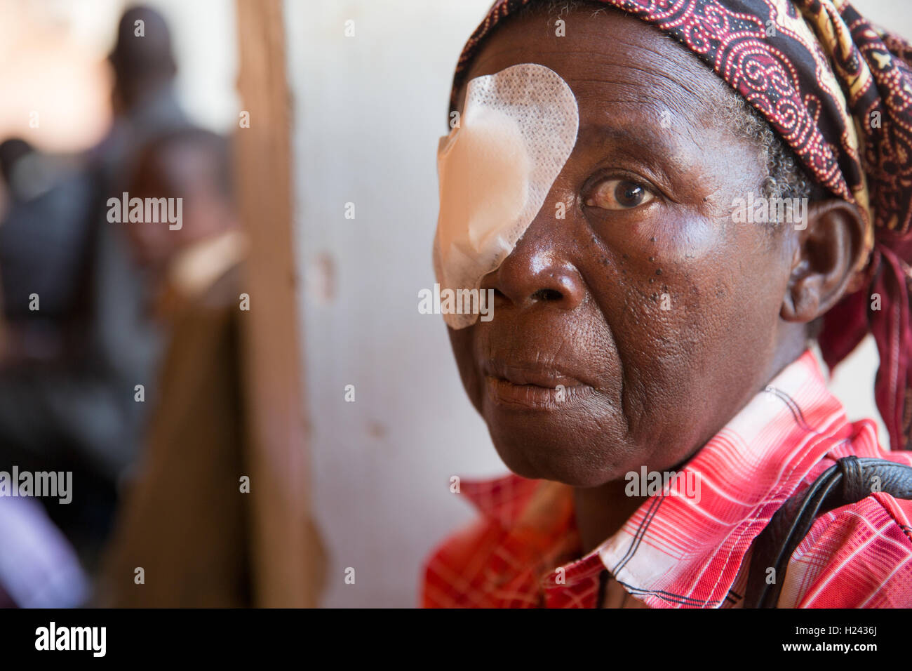 Ribaue Hospital, Ribaue,  Nampula Province, Mozambique, August 2015: Benficiary Luisa Muawalo  about to have her bandage removed after cataract operation the day before. . Photo by Mike Goldwater Stock Photo