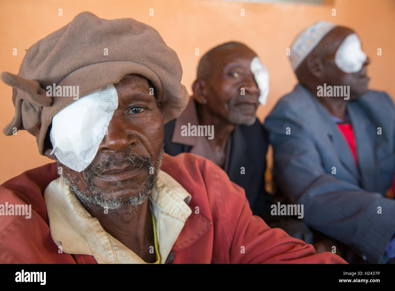 Ribaue Hospital, Ribaue,  Nampula Province, Mozambique, August 2015: Chico Alapueia from Malema, about to have their bandage removed after cataract operation the day before.  Photo by Mike Goldwater Stock Photo