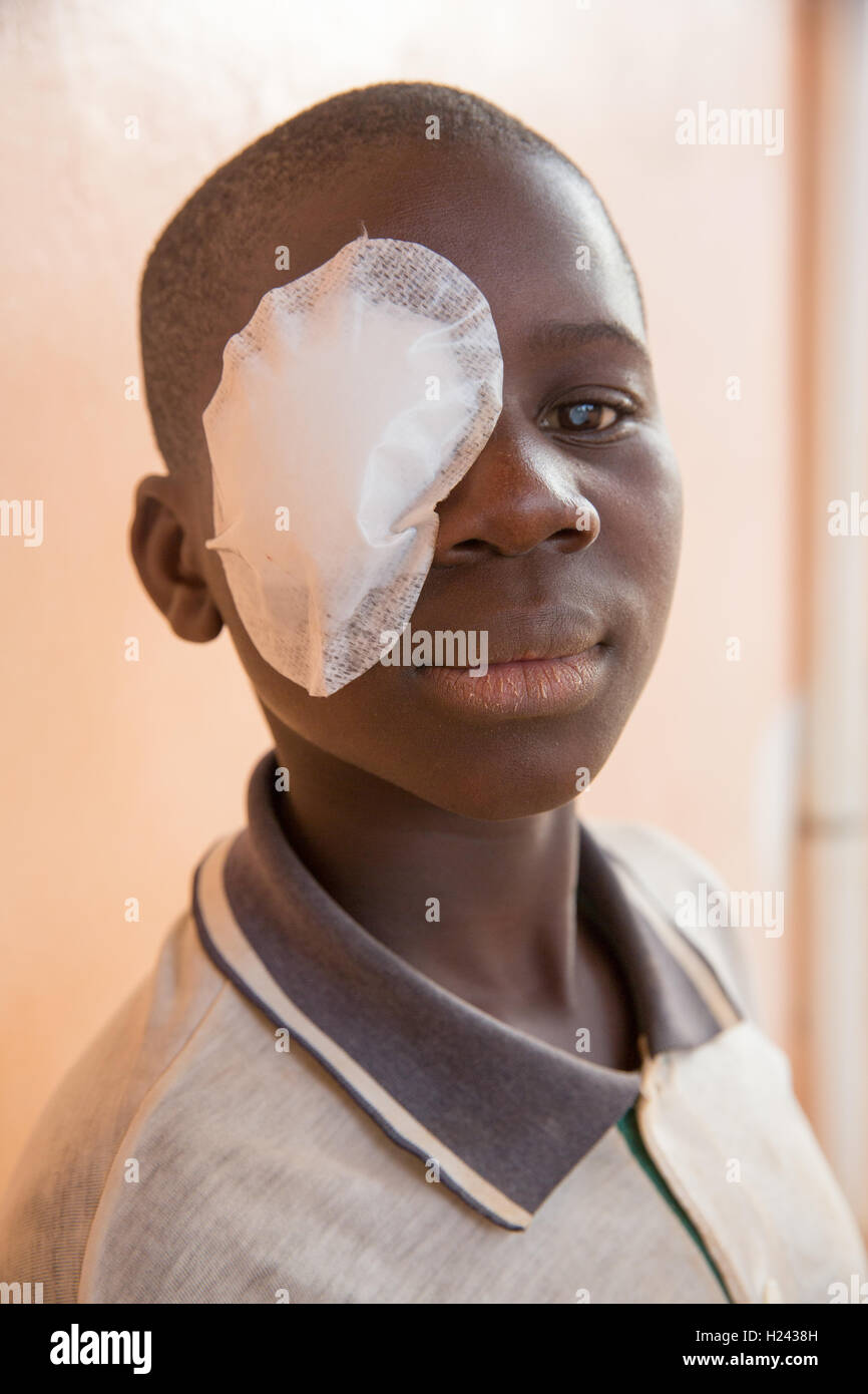 Ribaue Hospital, Ribaue,  Nampula Province, Mozambique, August 2015:  Saide Antonio, 16, with bilateral cataracts, about to have his bandage removed after cataract operations the day before.  Photo by Mike Goldwater Stock Photo